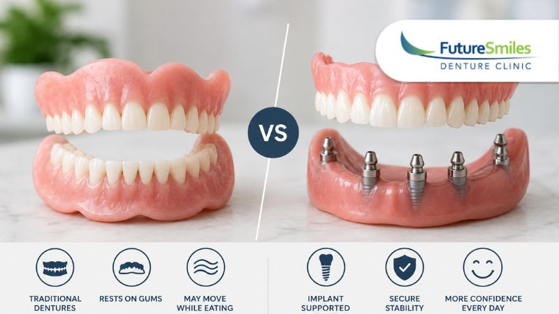 Can Implant-Supported Dentures Replace Traditional Dentures?